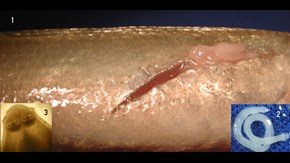 Bild 1: larvstadium i muskulatur på mellanvärd. Bild 2: Fripreparerad larv. Bild 3: Närbild av huvud (scolex).