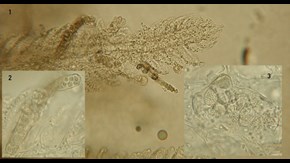 Branchiomyces demigrans-infektion i gälvävnad. Bild 1: Bakgrundsbild med en degenererad gäle. Bild 2, infälld vänster hörn: långsmal hyfbildning med sporer i gälens sekundärlamell. Bild 3, infälld vänster: trombliknande sporbildning i gälens primärlamell.