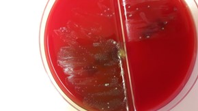 Helcococcus ser mest ut som en grönfärgning på plattan.