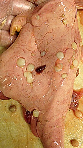 Cystor av T. nodulosus i lever från lake.