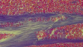 Kräftmuskulatur (blå färg) med sporer av T. contejeani (röd färg), mikroskopisk bild.