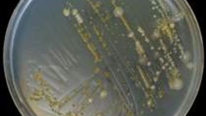 Bild 2. Växt av gula kolonier av F. psychrophilum vid odling direkt ifrån hud på TYES agar.