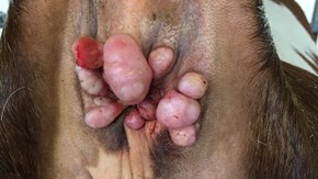 Papillom runt anus och vulva på en kviga som smittats via rektalhandskar.