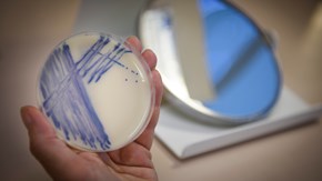 En hand håller upp en agarplatta med bakteriekultur