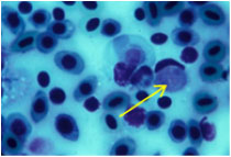 Blodparasiten leukocytozon i en röd blodkropp, illustrerat via en bild med ljusblå bakgrund fylld med prickar i olika mörkblå nyanser.