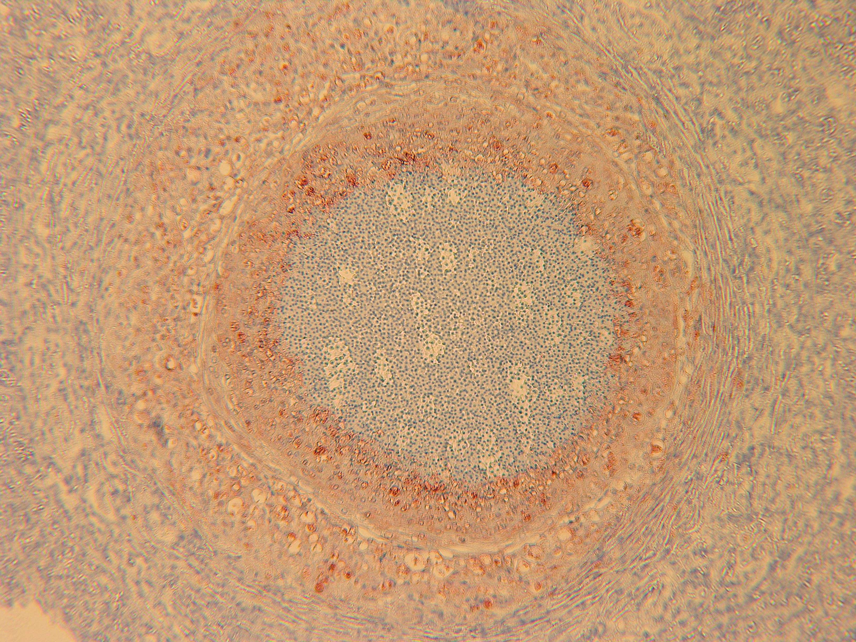 Rödfärgade områden visar förekomst av bakterien Francisella noatunensis subsp. noatunensis, Immunohistokemi x 250.