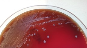 Lactococcus på agar