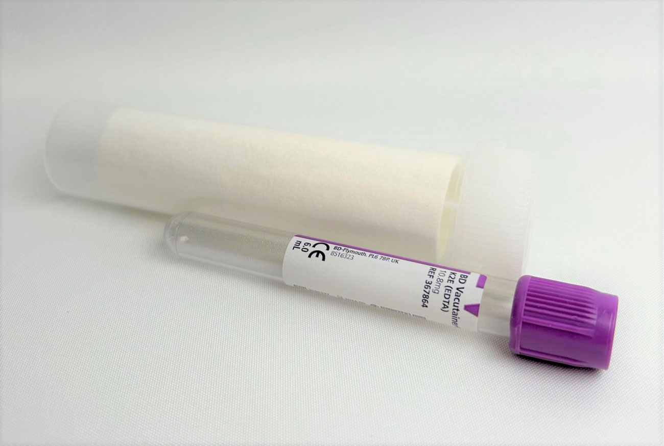 Vacutainerrör med EDTA 6 ml och transporthylsa.