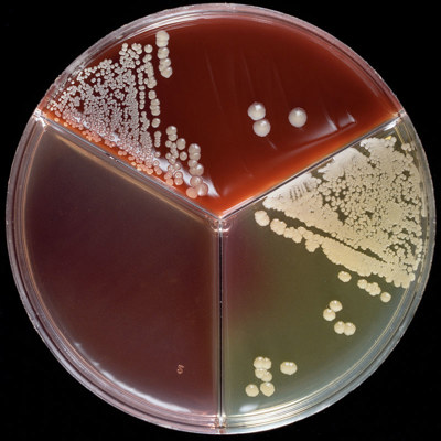 NAS-bakterier ("non-aureus staphylococci") på en agarplatta med tre fält.