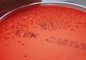 Närbild av bakterien Streptococcus agalactiae på en röd agarplatta.