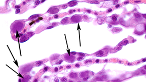 Epiteliocystis hos lax