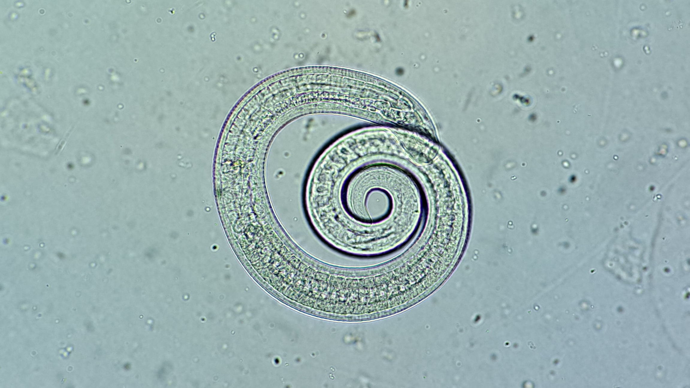 Trikin från undersökning i mikroskop.