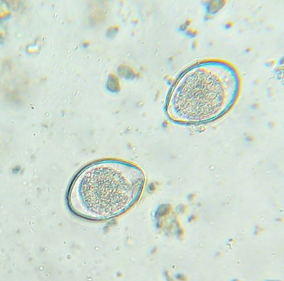 Oocystor av Cystoisospora felis