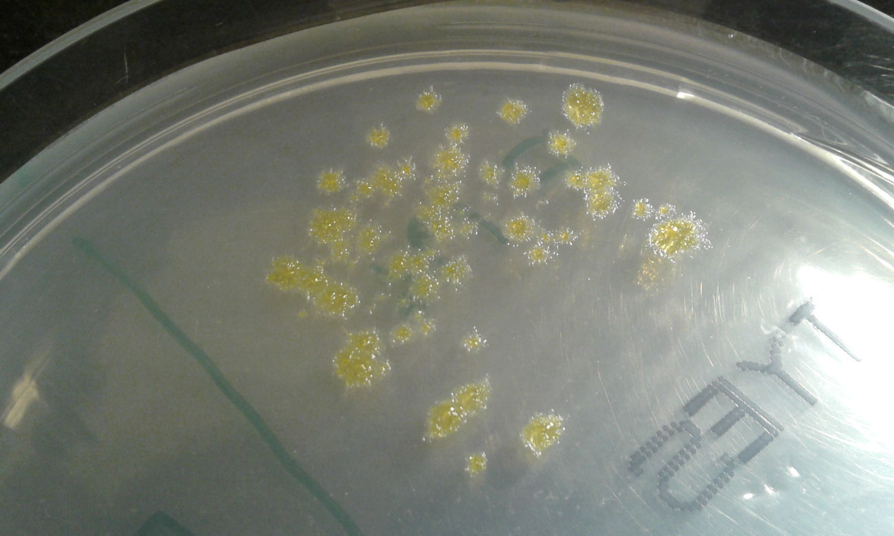 Bakterien Flavobacterium columnare på en agarplatta.