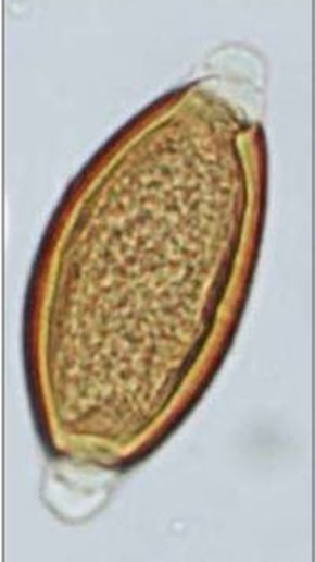 Mikrockopbild på ovalt gulbrunt ägg.