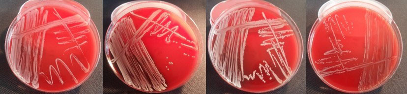 NAS-bakterier (”non-aureus staphylococci"), tidigare koagulasnegativa stafylokocker, på fyra röda agarplattor.