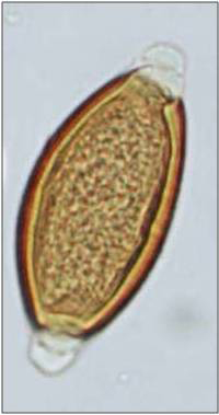 Piskmaskägg (Trichuris trichiura) sett i mikroskop.