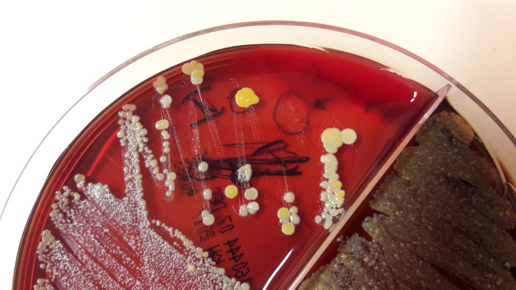 Staphylococcus aureus på en agarplatta (närbild).