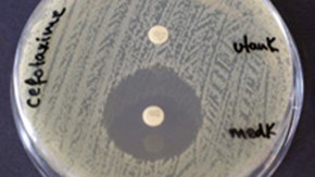 en agarplatta med bakteriekolonier