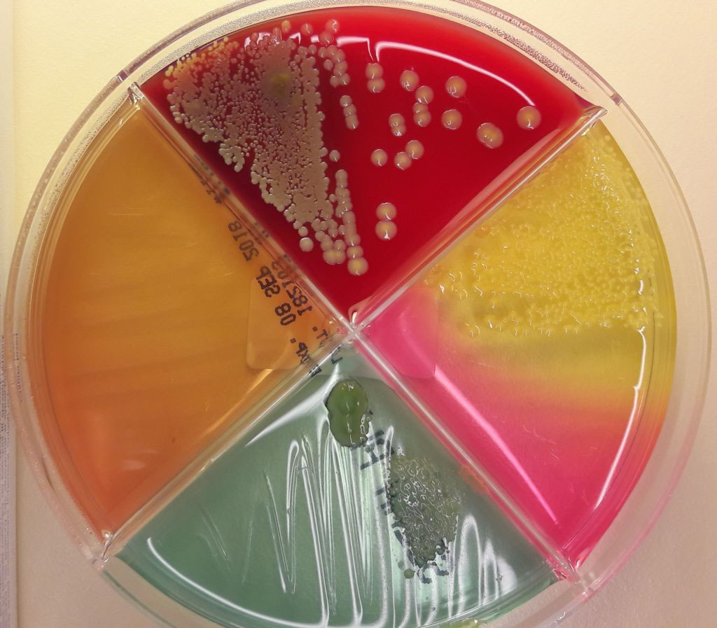 Bakterien Staphylococcus aureus på en agarplatta med fyra fält.