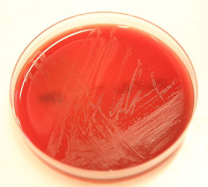 Bakterien Erysipelothrix rhusiopathiae på en agarplatta.