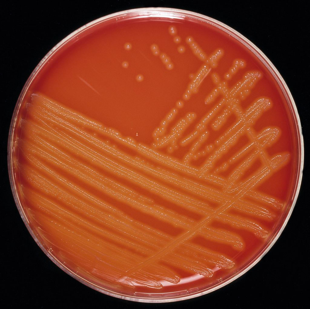 Bakterien Streptococcus agalactiae på en röd agarplatta.
