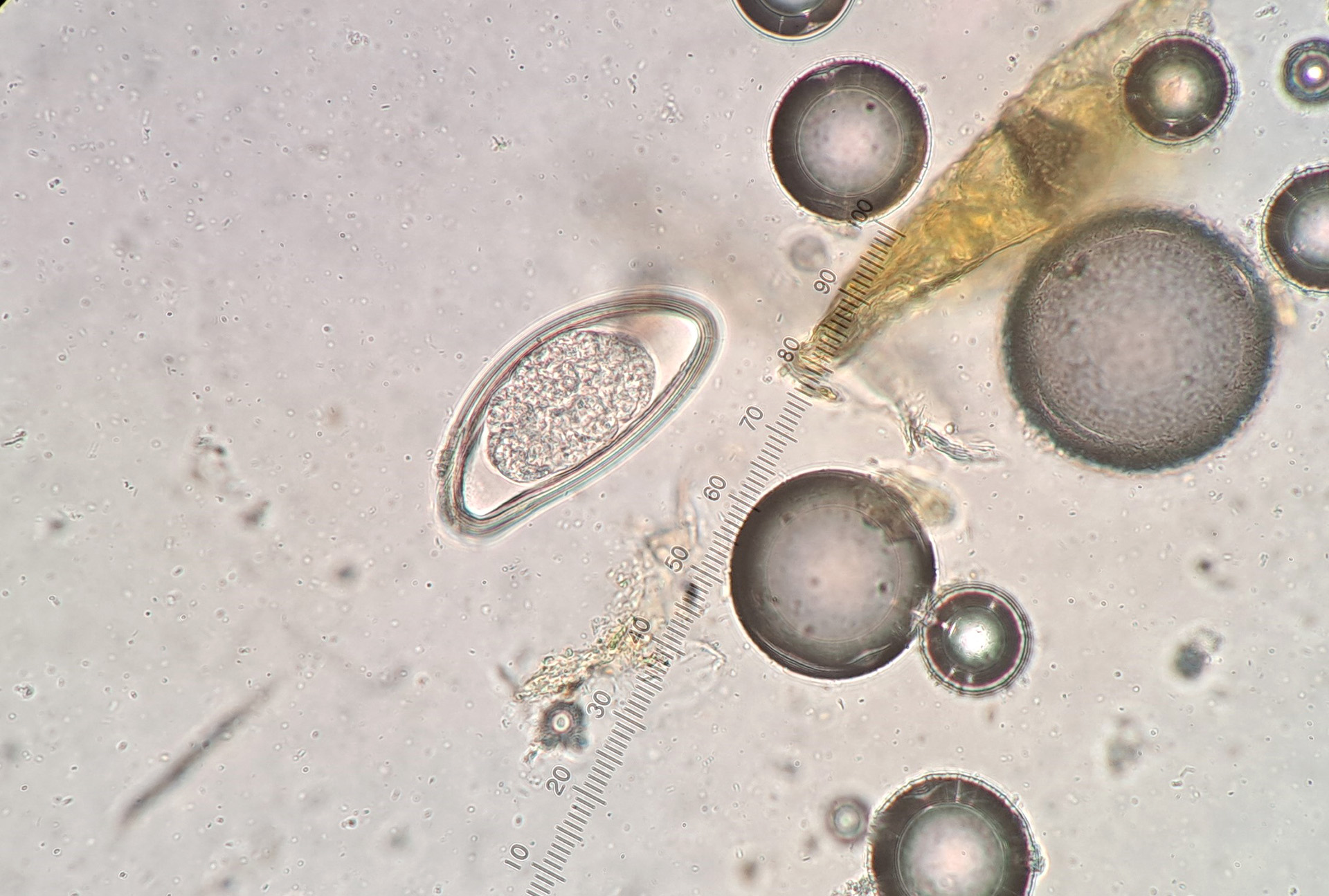 Ett parasitägg fotat i närbild i mikroskop.