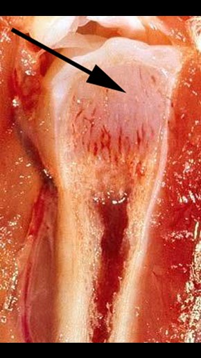 Bild 2. Kraftigt breddad tillväxtzon i benet under knäleden (proximala tibiotarsus) hos en kyckling med rakitis.