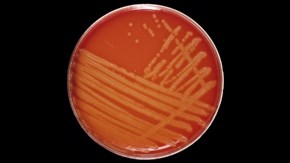 Streptococcus agalactiae.