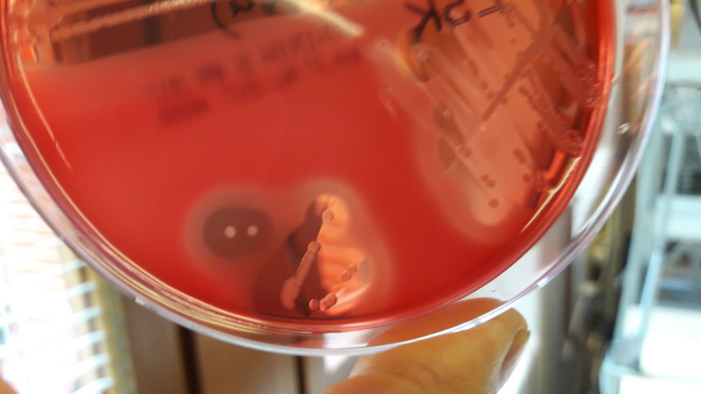 Närbild på ljusröd agarplatta med Lysinibacillus species, där undre halvan av plattan syns.