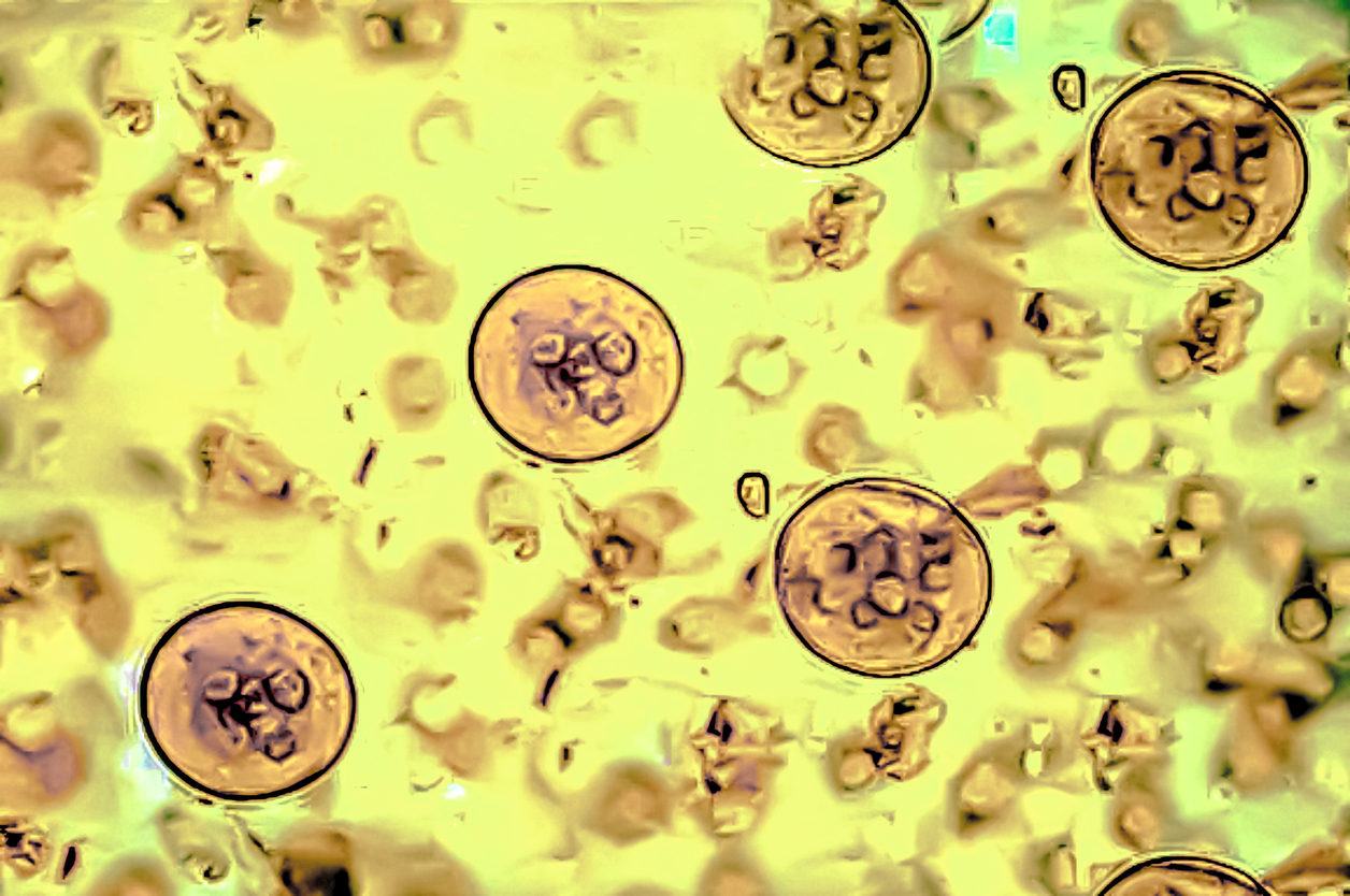 Cryptosporidium